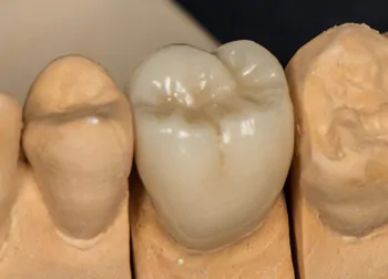 症例４治療経過