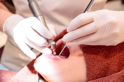 歯のクリーニング