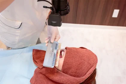 口腔内写真撮影