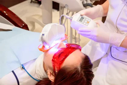 ホワイトニング剤の塗布と光照射