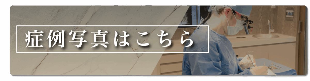 症例写真はこちらバナー