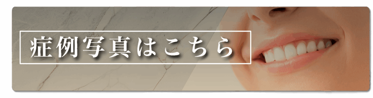 症例写真はこちらバナー