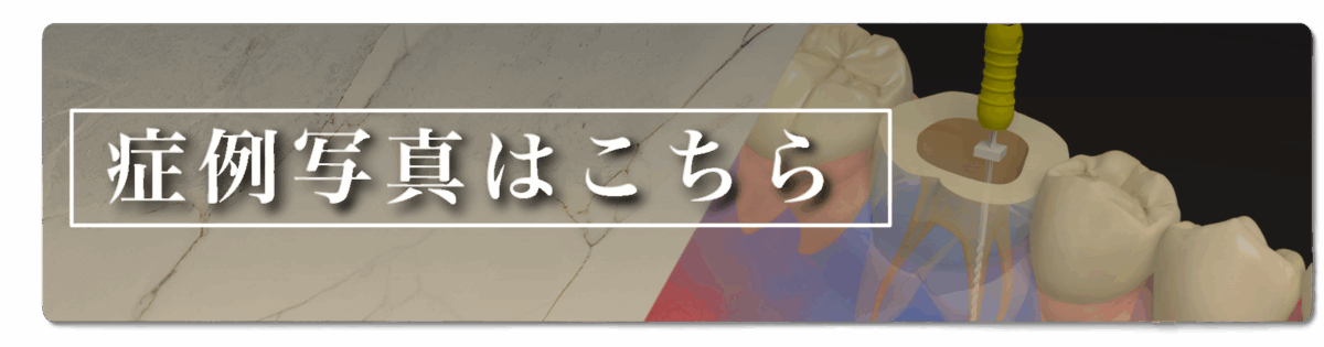 症例写真はこちらバナー