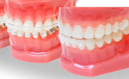 矯正歯科の症例