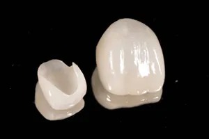 熟練の歯科技工士との連携で、質の高い仕上がりを