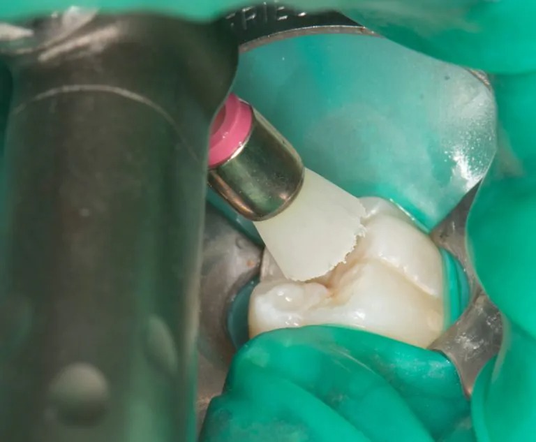 表面の汚れをとります