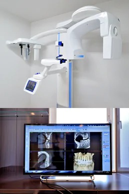 歯科用CT