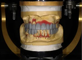 症例5治療開始前