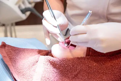 メインテナンス