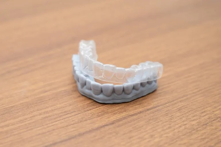 インハウスアライナー