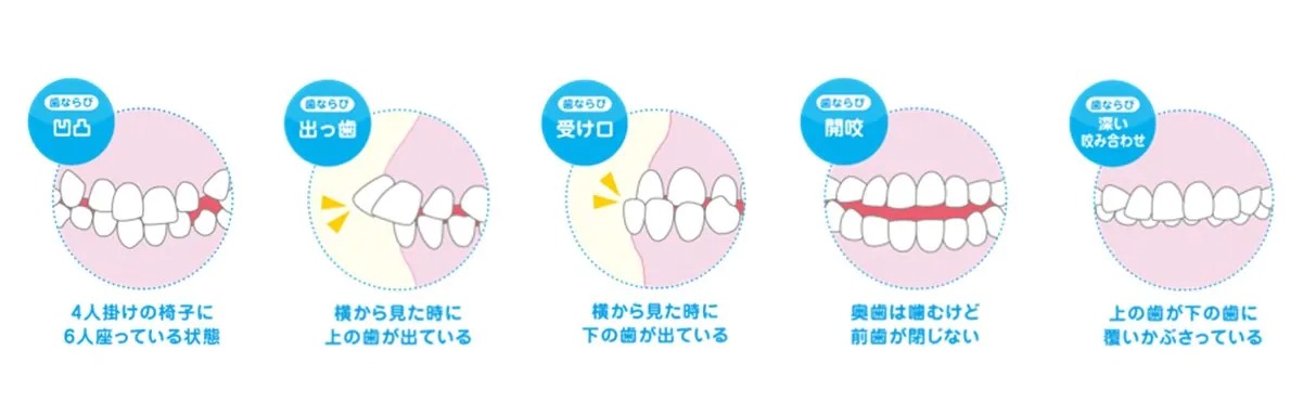 プレオルソで対応できる症例