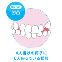 拡大床で対応できる症例