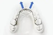 リンガルアーチ