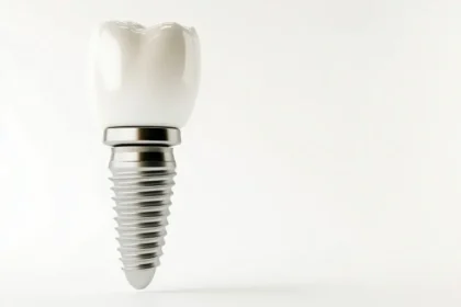 インプラント10年保証で安心をサポート