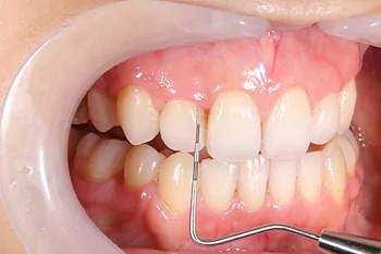 予防メンテナンスの流れ