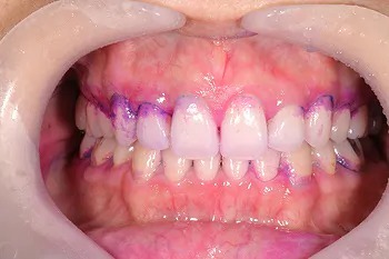 予防メンテナンスの流れ