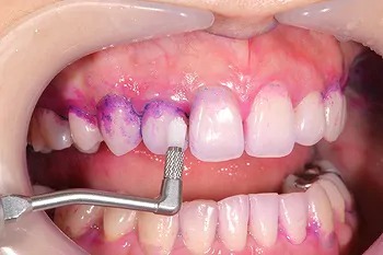 予防メンテナンスの流れ