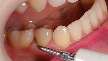 予防メンテナンスの流れ