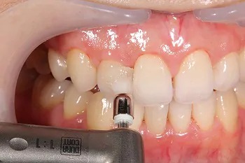 予防メンテナンスの流れ