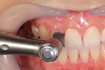 予防メンテナンスの流れ