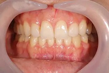 予防メンテナンスの流れ