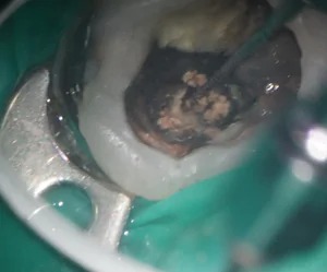 マイクロスコープ