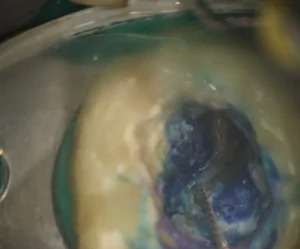 マイクロスコープ