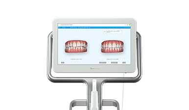 口腔内スキャナーiTero