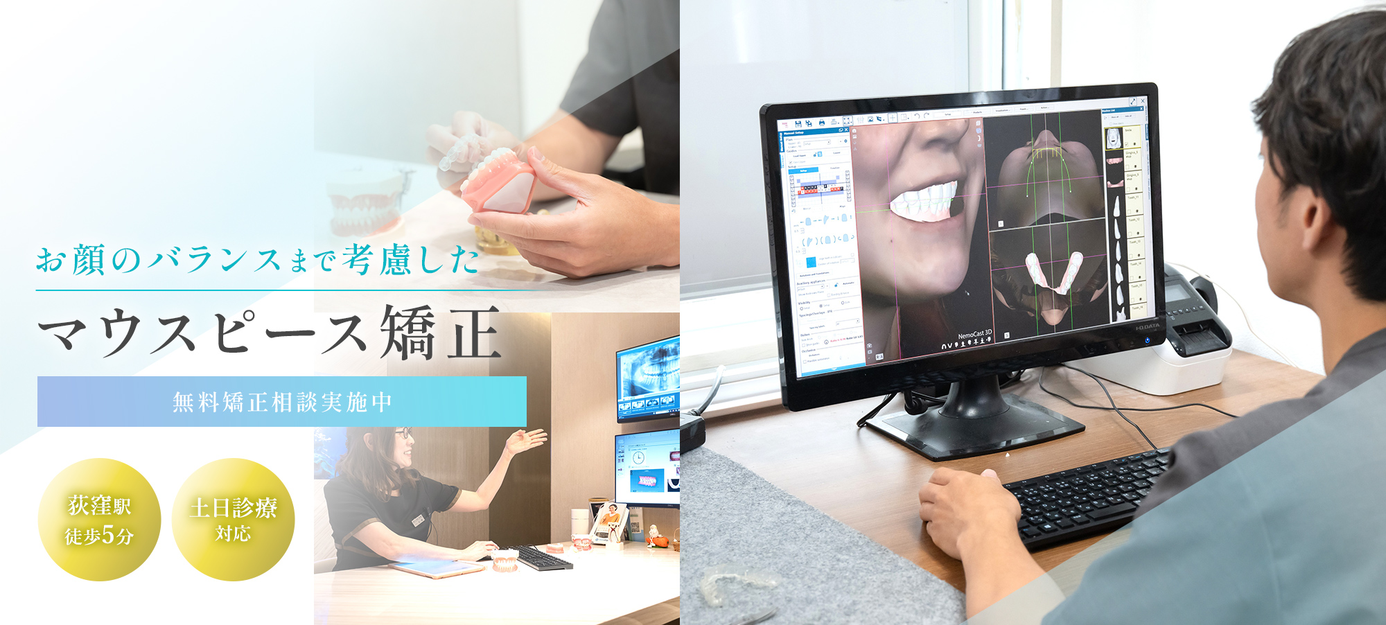 お顔のバランスまで考慮したマウスピース矯正 無料矯正相談実施中 荻窪駅徒歩5分 土日診療対応
