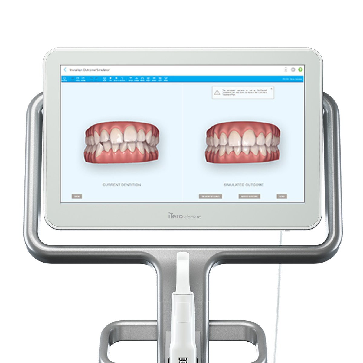口腔内3Dスキャナー「iTero」