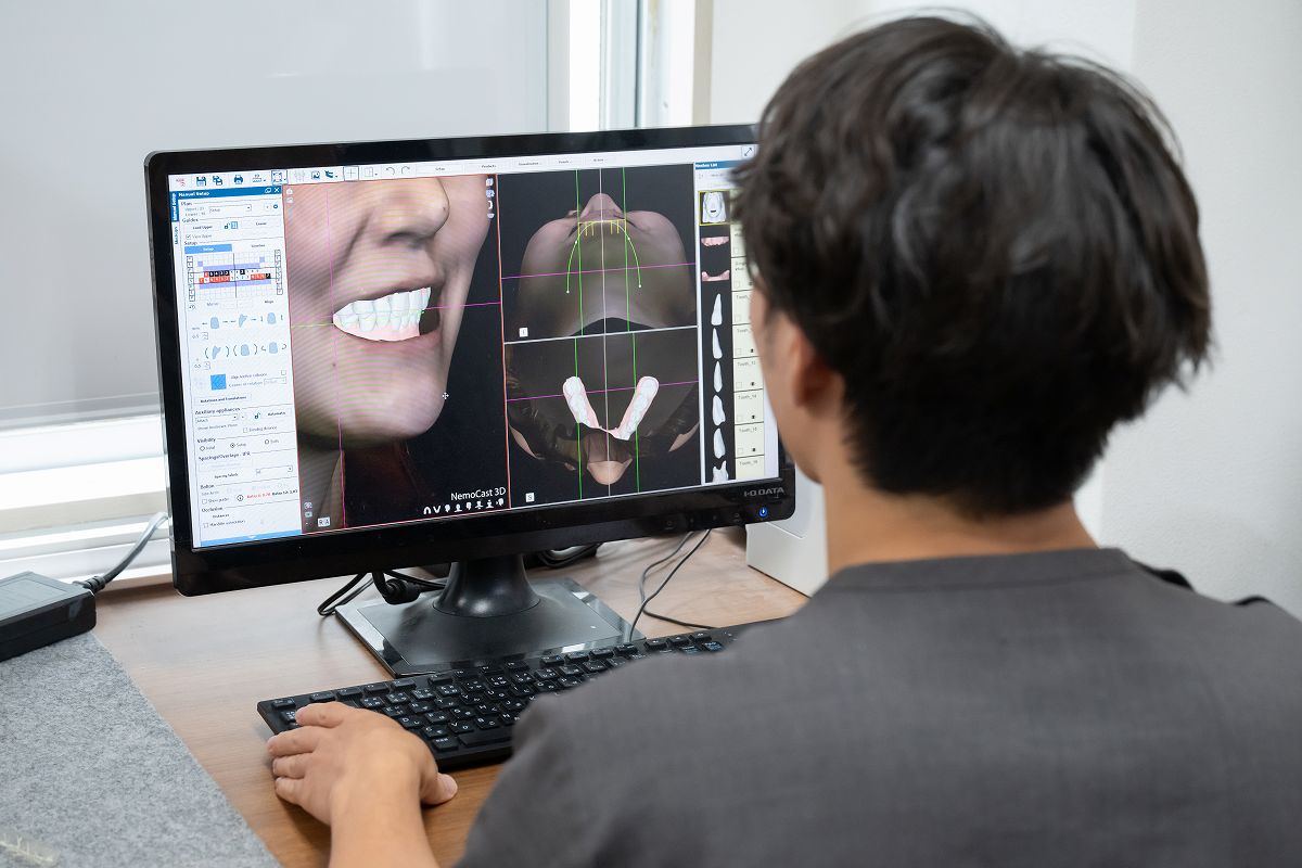 Ray Faceで顔貌・横顔を事前にシミュレーション