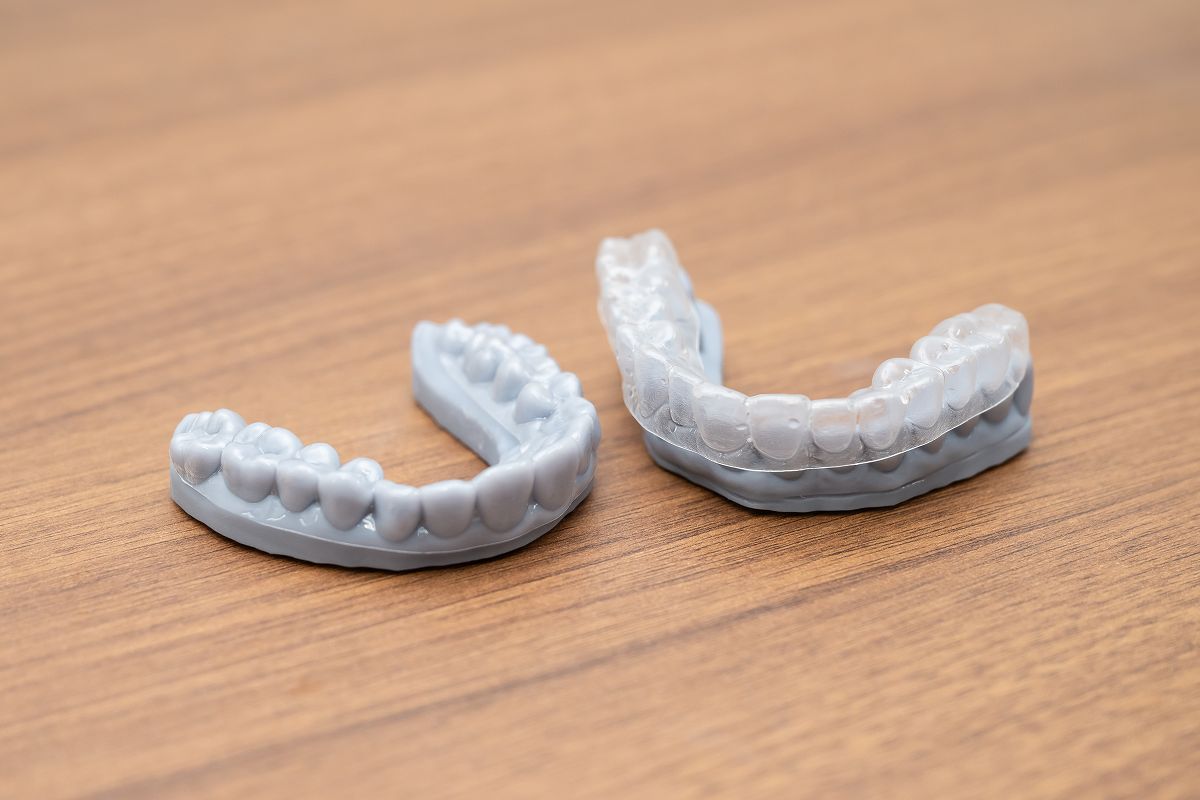 インハウスアライナーとは