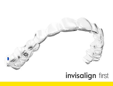 インビザライン・ファースト