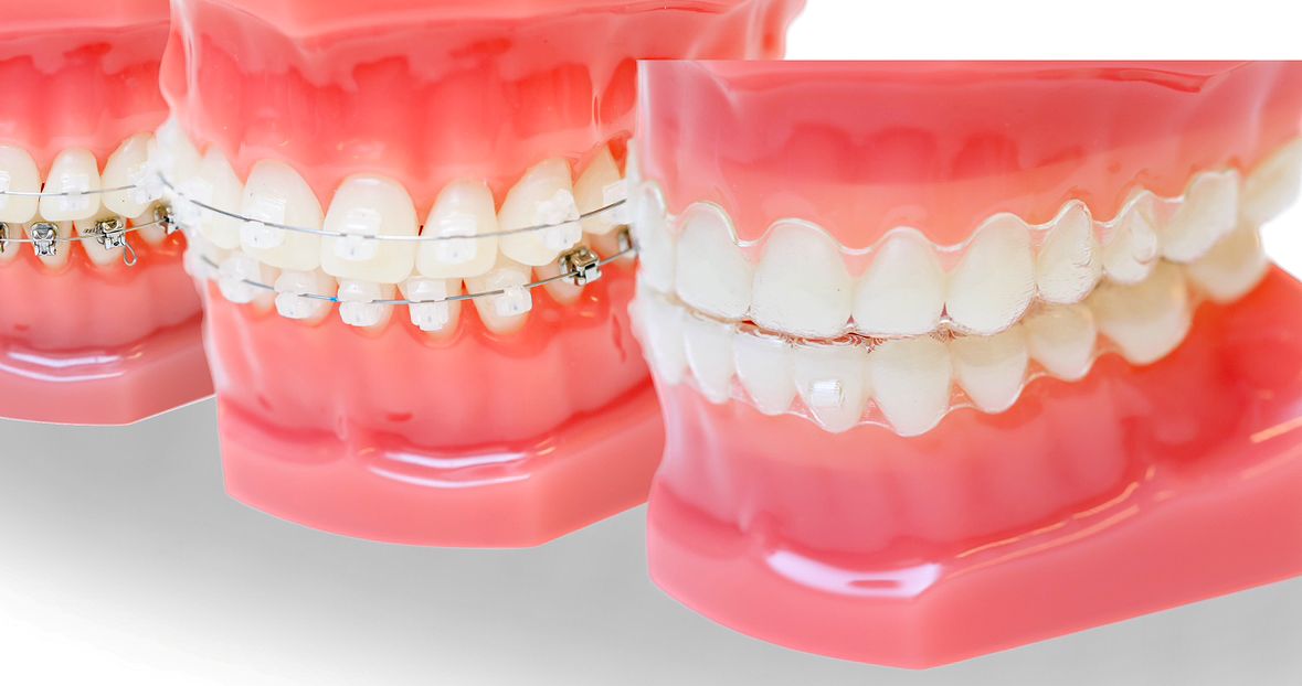 矯正歯科について