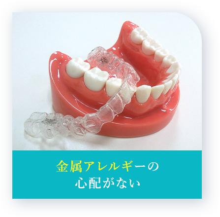 金属アレルギーの心配がない