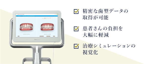 精密な歯型データの取得が可能 患者さんの負担を大幅に軽減 治療シミュレーションの視覚化