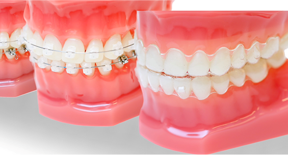 マウスピースだけでは解決できない複雑な症例にも対応