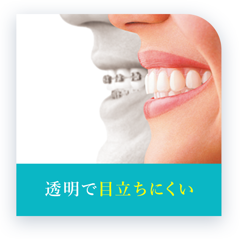 透明で目立ちにくい