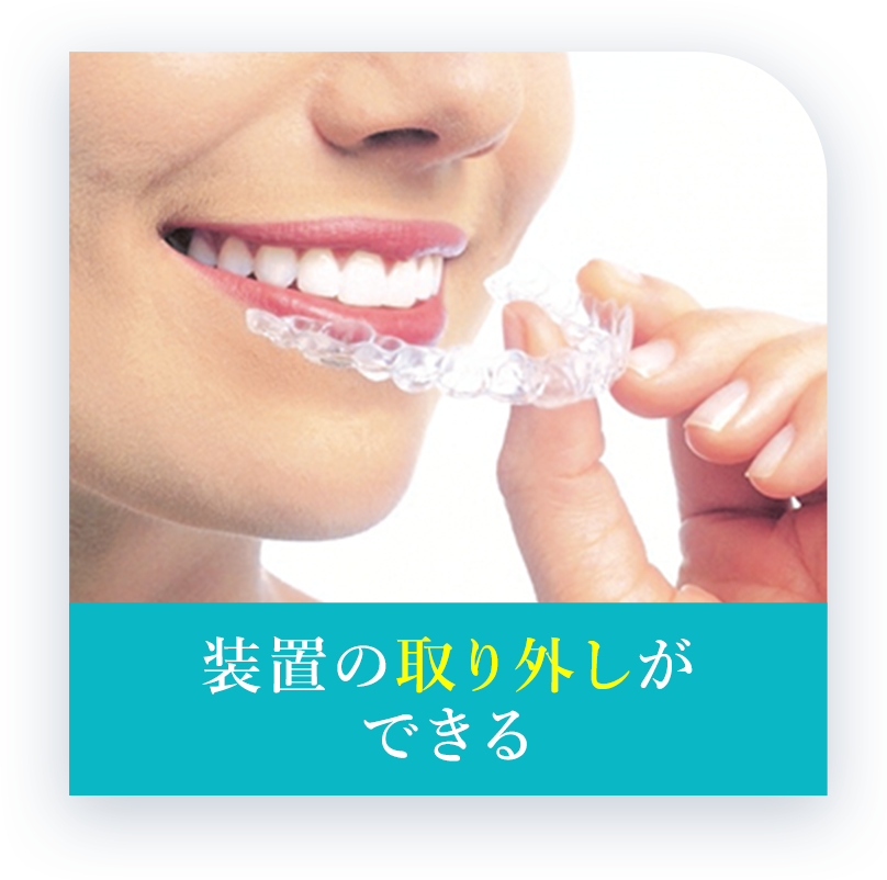 装置の取り外しができる