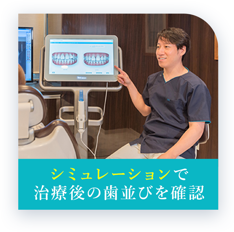 シミュレーションで治療後の歯並びを確認