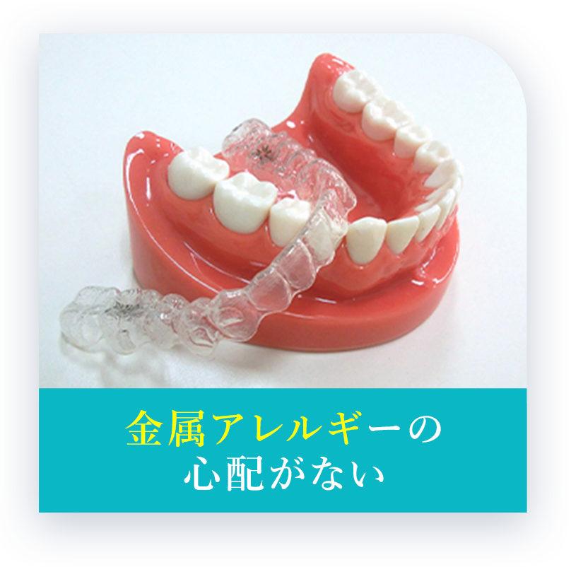 金属アレルギーの心配がない