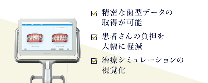 精密な歯型データの取得が可能 患者さんの負担を大幅に軽減 治療シミュレーションの視覚化