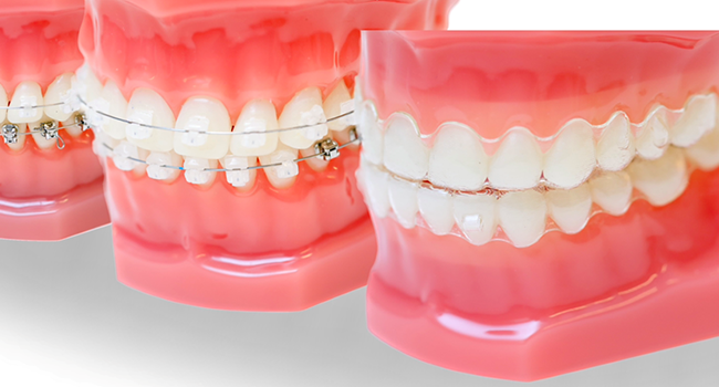 マウスピースだけでは解決できない複雑な症例にも対応