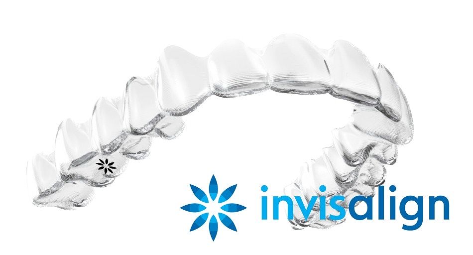 インビザラインは、非抜歯の矯正治療が得意