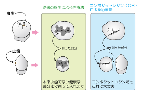 治療の特徴