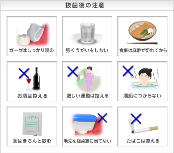 抜歯後や外科処置後の注意点は？